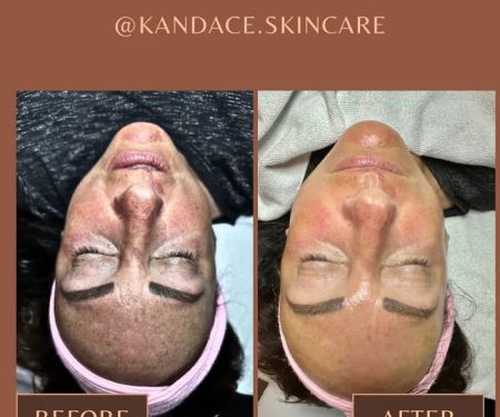Kandace's Skin Care LLC