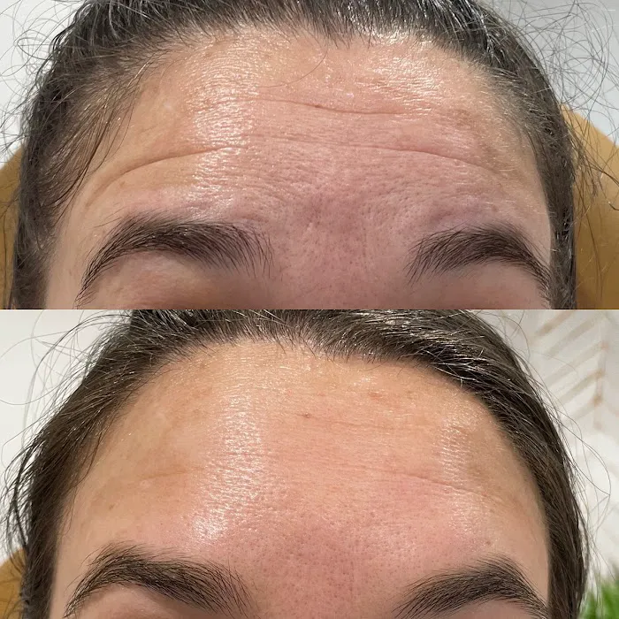 Symmetry Medical Aesthetics Picture 3