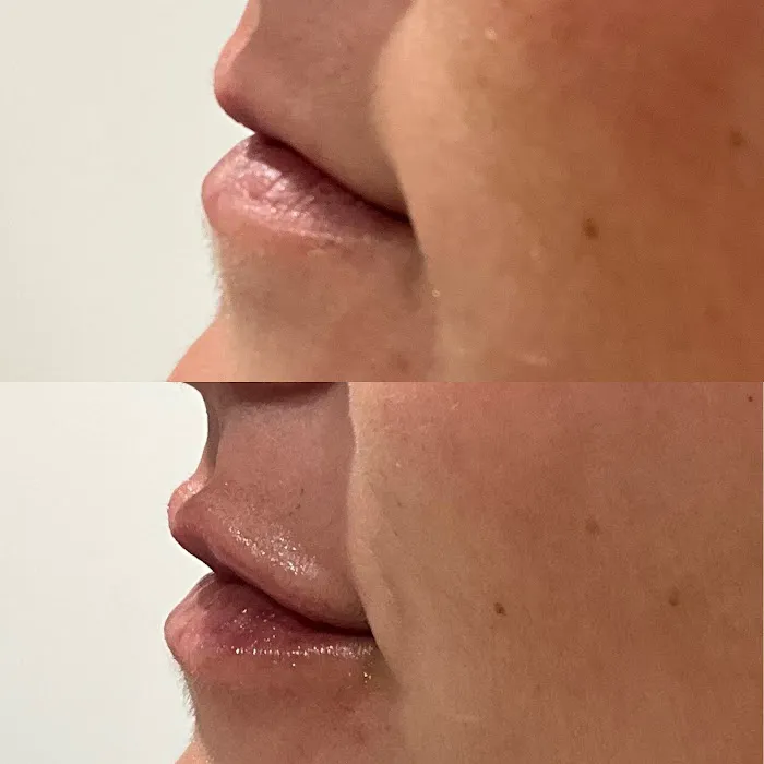 Symmetry Medical Aesthetics Picture 7