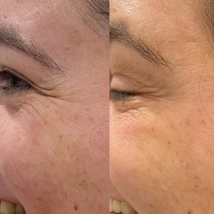 Symmetry Medical Aesthetics Picture 5