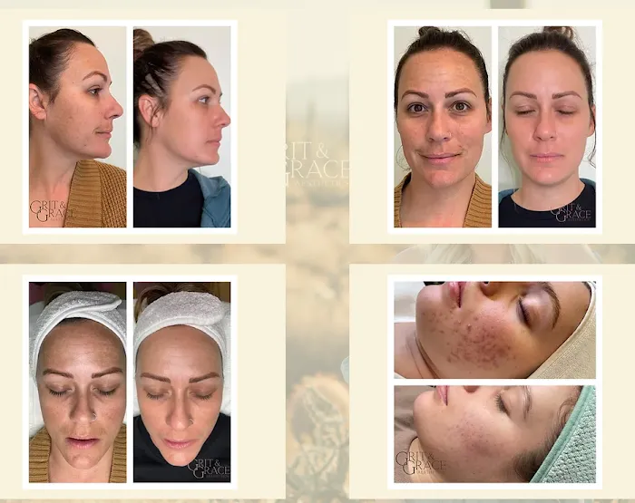 Grit & Grace Aesthetics Picture 6