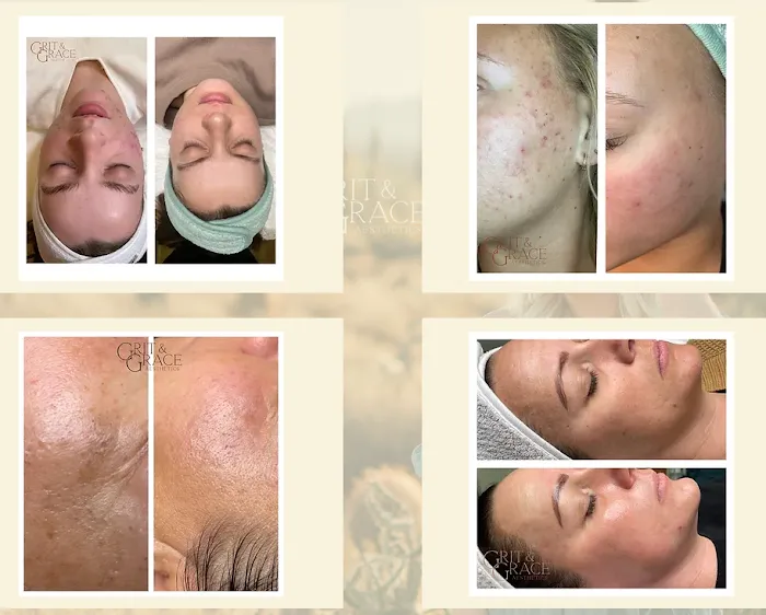 Grit & Grace Aesthetics Picture 7