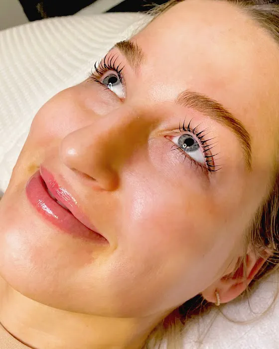 HydraFacial: High Brow Aesthetics Picture 1