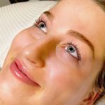 HydraFacial: High Brow Aesthetics