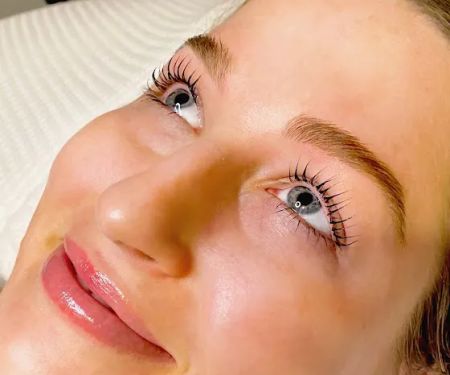 HydraFacial: High Brow Aesthetics