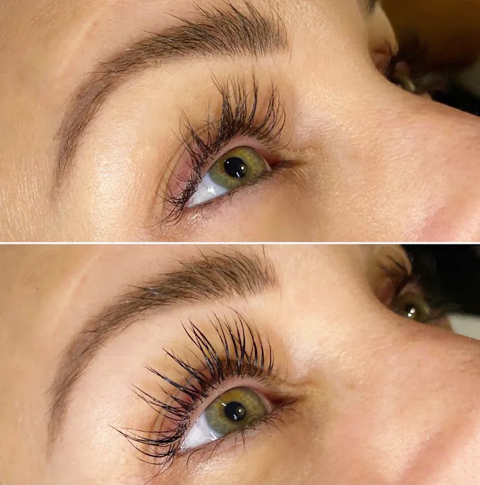 HydraFacial: High Brow Aesthetics Picture 4