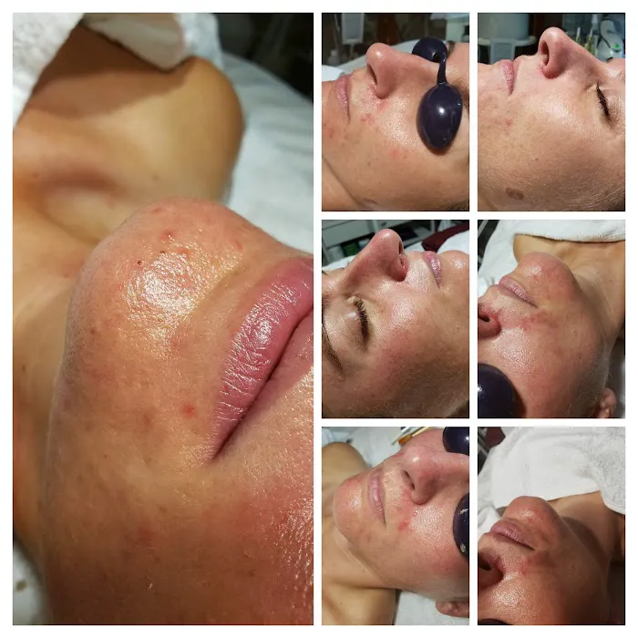 Ima'gery Skin Care - Skin Care Salon Phoenix Picture 8