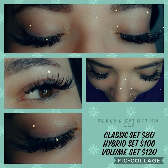 Serene Esthetics LLC Picture 5