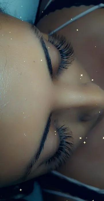 Serene Esthetics LLC Picture 7