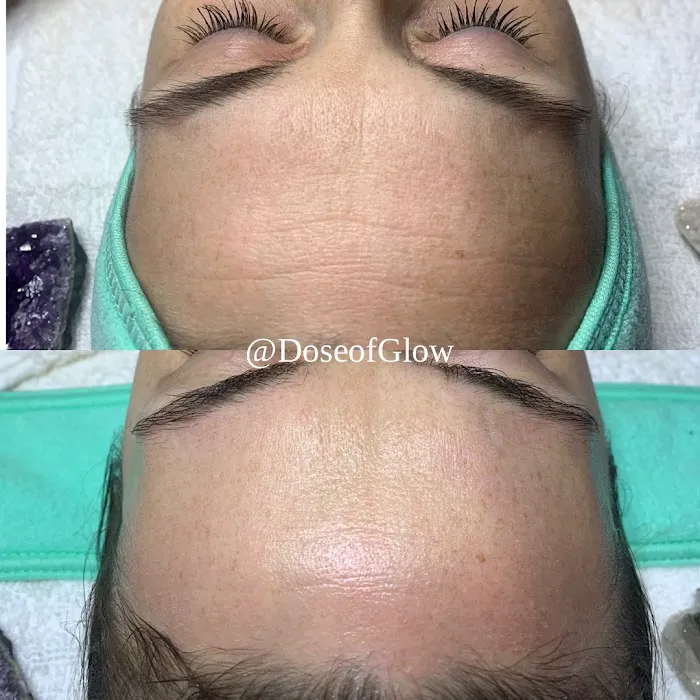 Dose of Glow Beauty LLC Picture 4