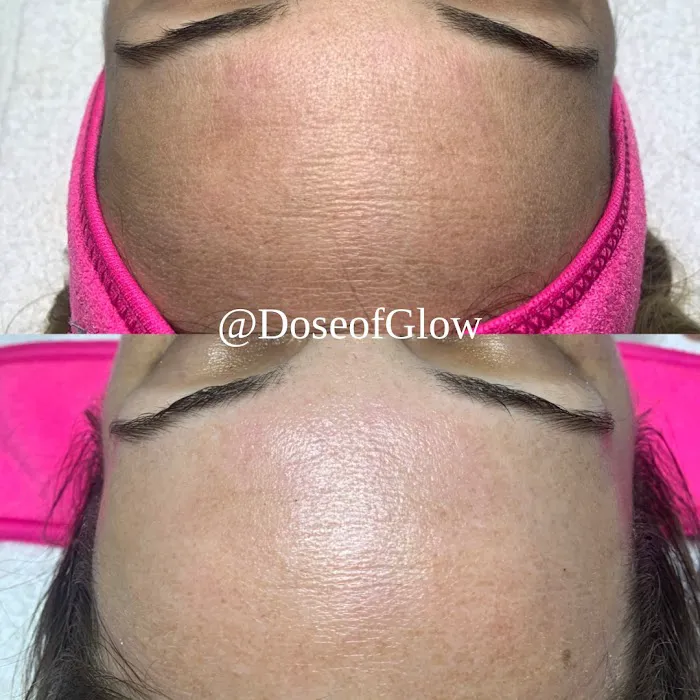 Dose of Glow Beauty LLC Picture 3