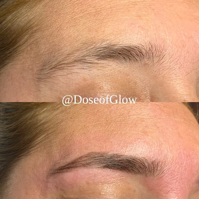 Dose of Glow Beauty LLC Picture 2