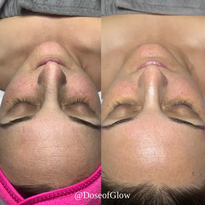 Dose of Glow Beauty LLC Picture 5