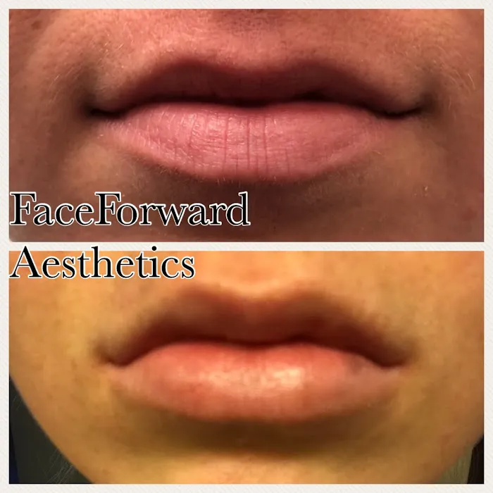 Dermaden Aesthetics Picture 4