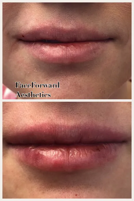 Dermaden Aesthetics Picture 5