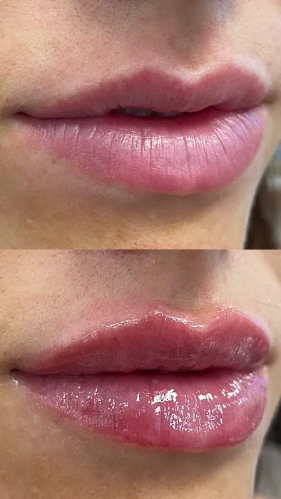 Quantum Wellness Med Spa Chandler Picture 3