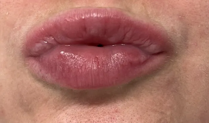 Quantum Wellness Med Spa Chandler Picture 1