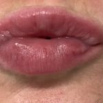 Quantum Wellness Med Spa Chandler