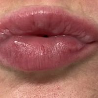 Quantum Wellness Med Spa Chandler ico