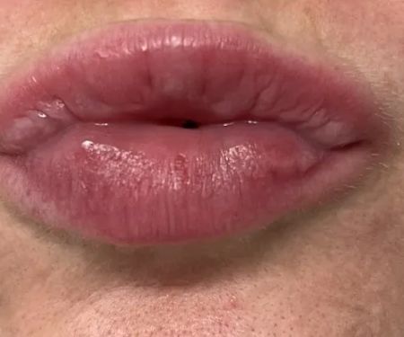 Quantum Wellness Med Spa Chandler