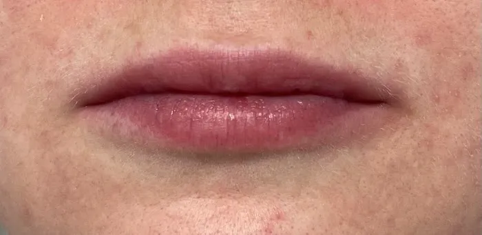 Quantum Wellness Med Spa Chandler Picture 6