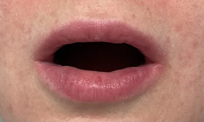 Quantum Wellness Med Spa Chandler Picture 5