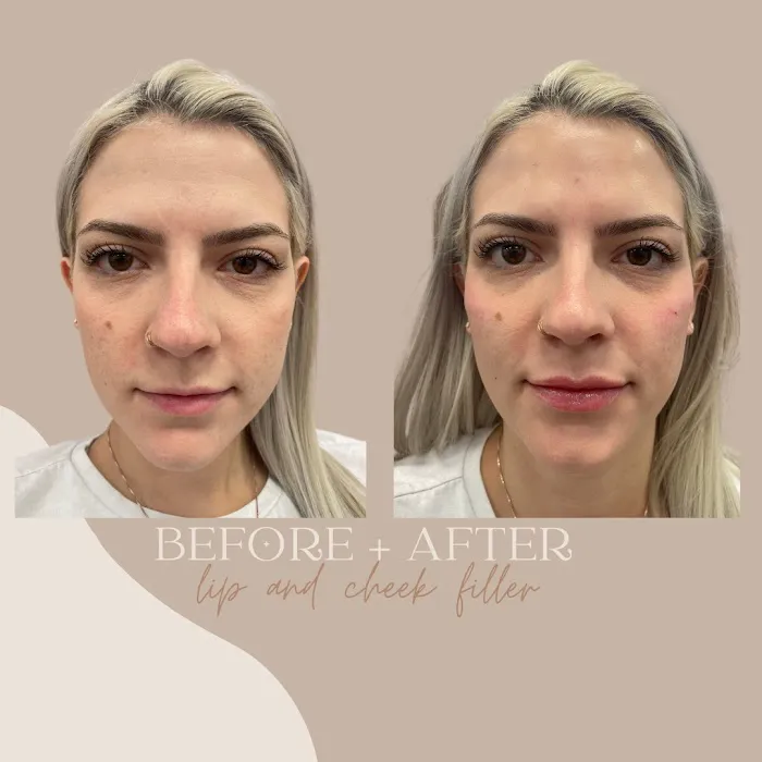 Quantum Wellness Med Spa Chandler Picture 7