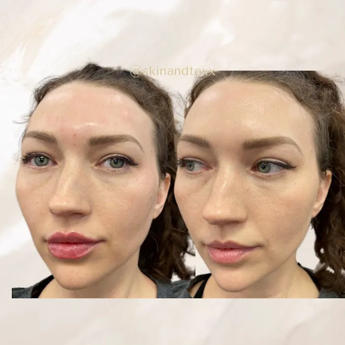 Quantum Wellness Med Spa Chandler Picture 8