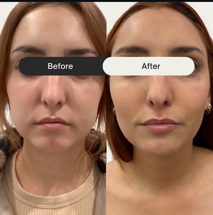 Quantum Wellness Med Spa Chandler Picture 10