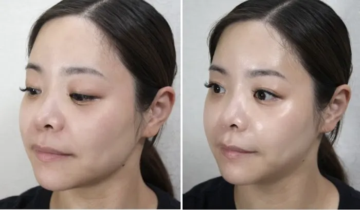 K-Aesthetics Pro Picture 6