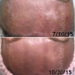 Skin Care Solutions LLC