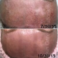 Skin Care Solutions LLC ico