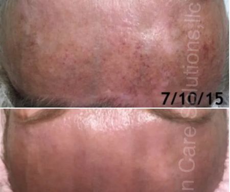 Skin Care Solutions LLC