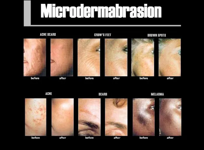 Skin Care 2-1-2 Picture 4