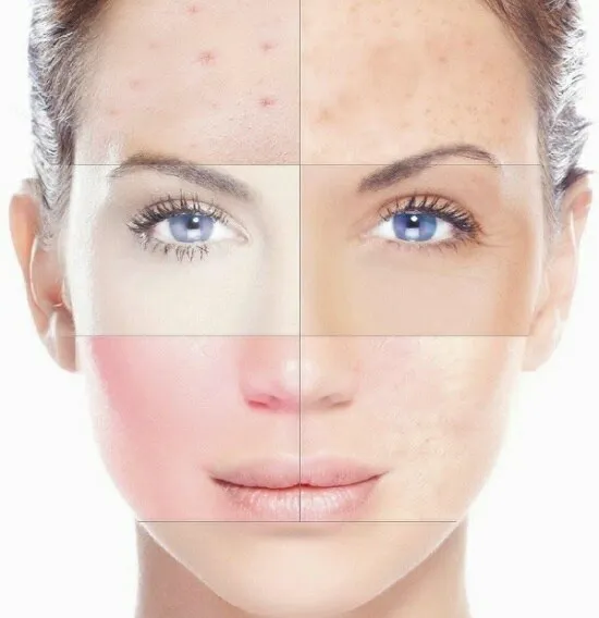 Skin Care 2-1-2 Picture 1