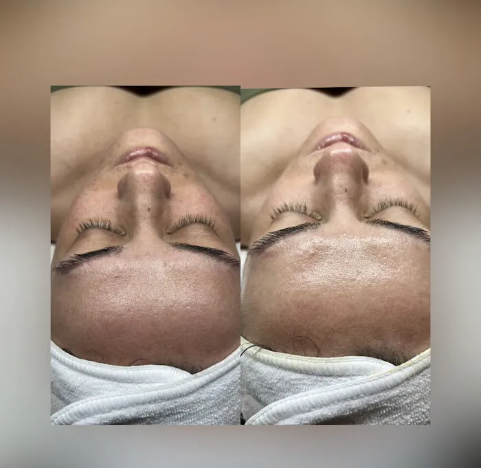 BareSkin Rx Med Spa Picture 6