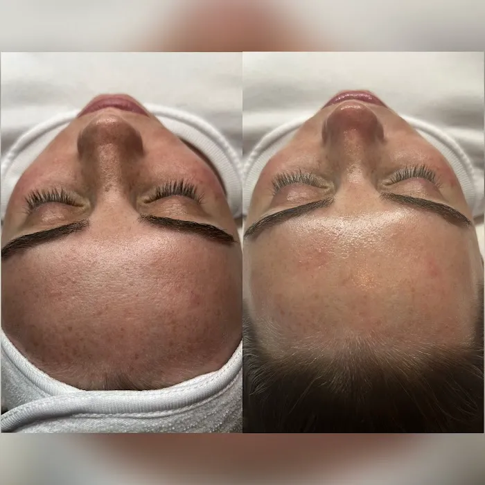 BareSkin Rx Med Spa Picture 5