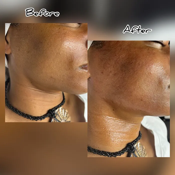 BareSkin Rx Med Spa Picture 8