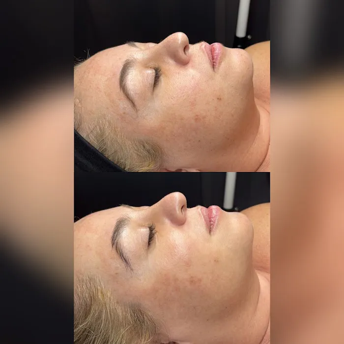 BareSkin Rx Med Spa Picture 4