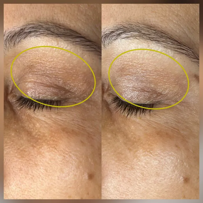 BareSkin Rx Med Spa Picture 10