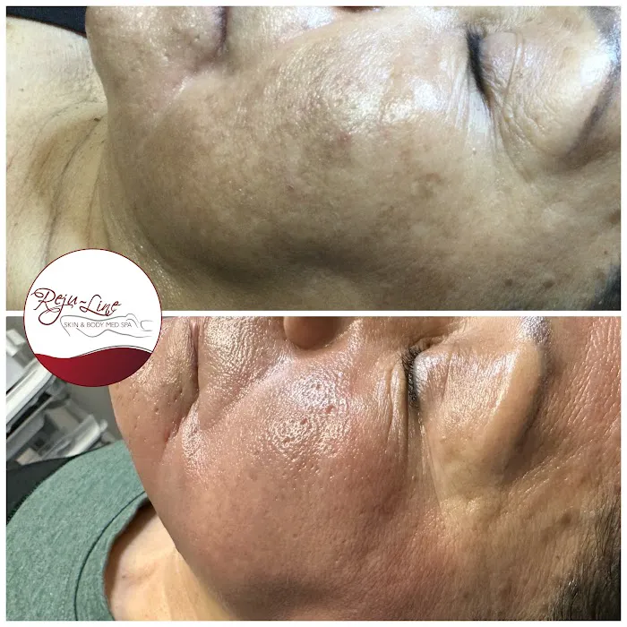 Rejuline skin and body Picture 4