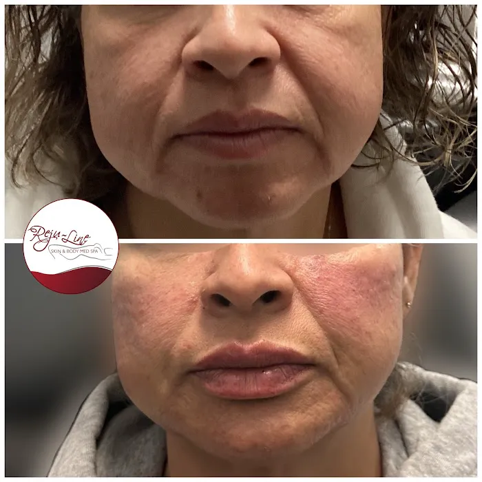 Rejuline skin and body Picture 2