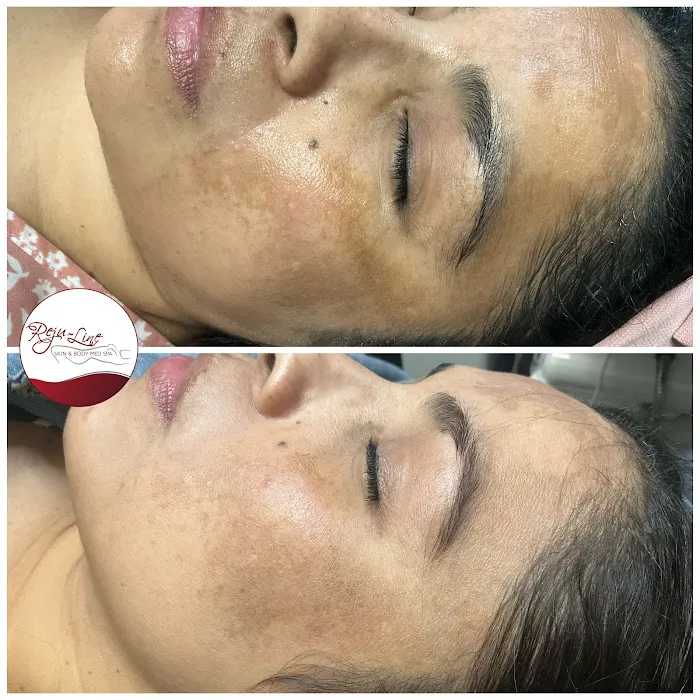 Rejuline skin and body Picture 3