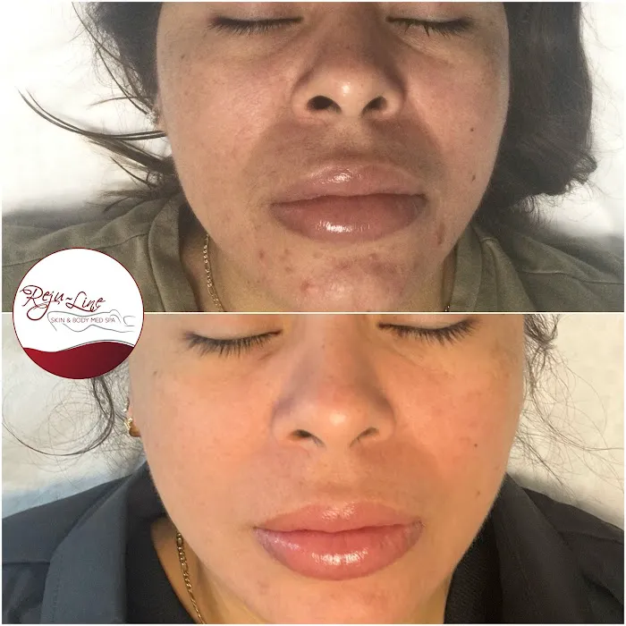 Rejuline skin and body Picture 5