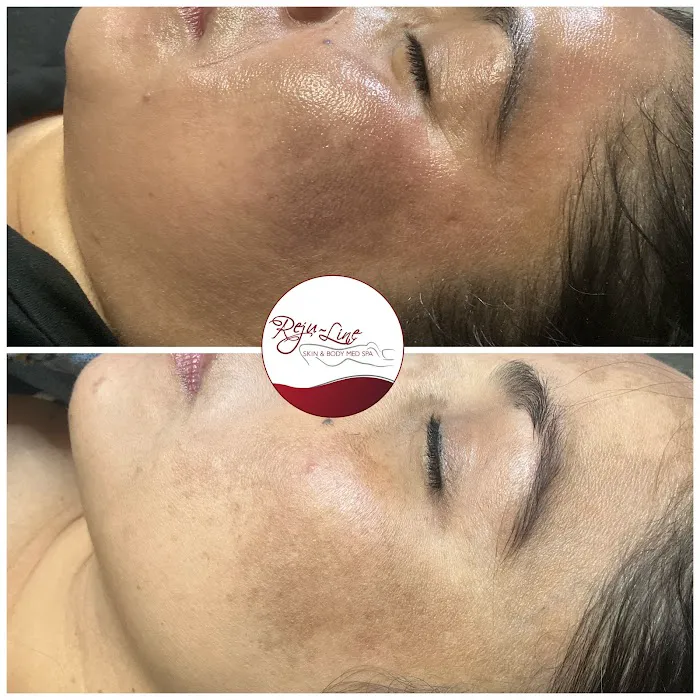 Rejuline skin and body Picture 10