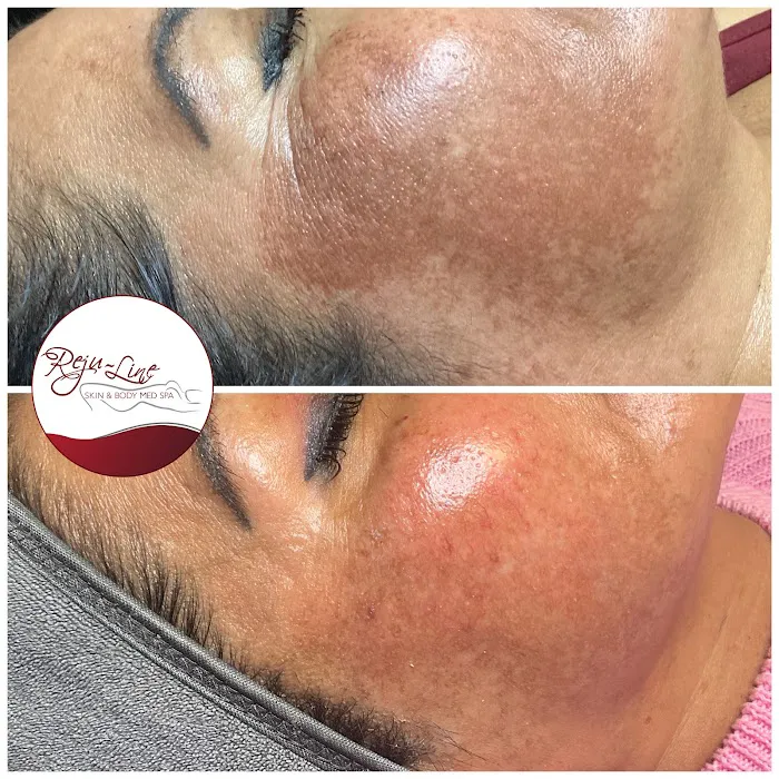 Rejuline skin and body Picture 7