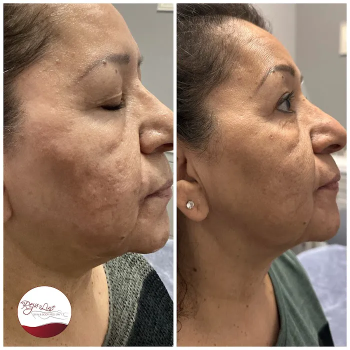 Rejuline skin and body Picture 8