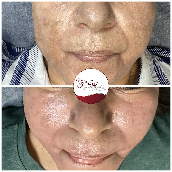 Rejuline skin and body Picture 9