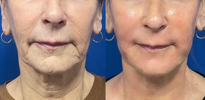 AZ Skin Therapy Picture 8