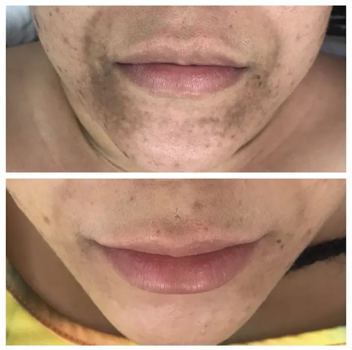 KS Aesthetics LLC Picture 5